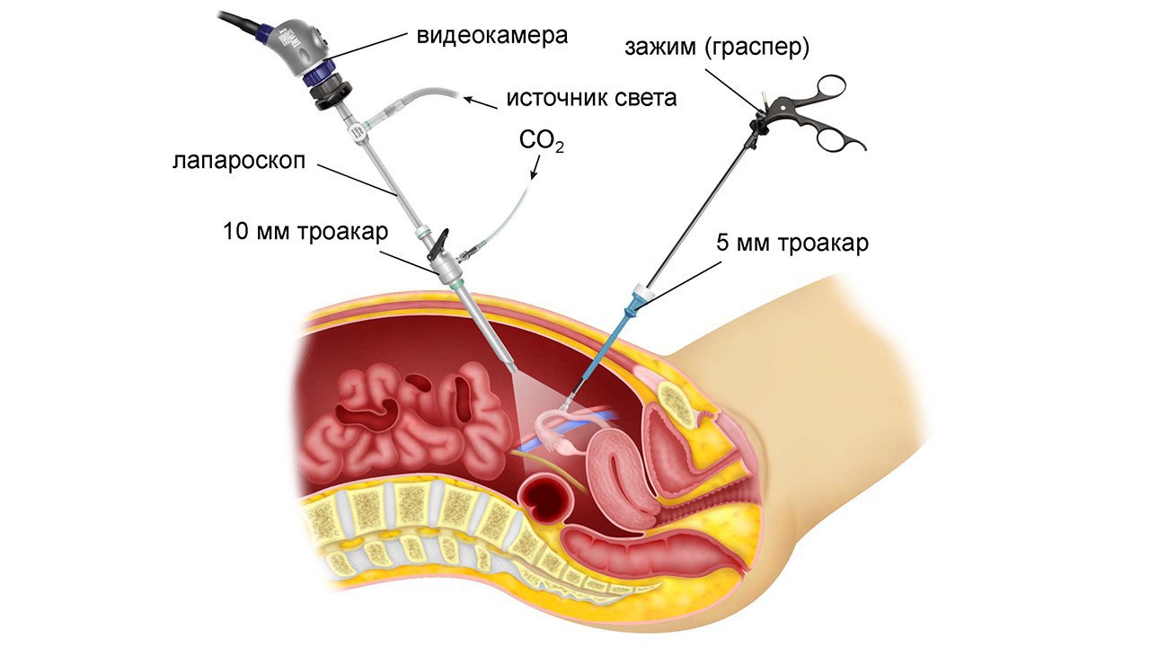 Фото: Особенности проведения операции